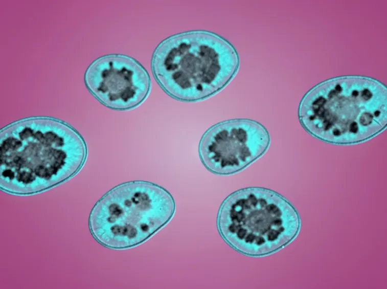 Mononucleosi