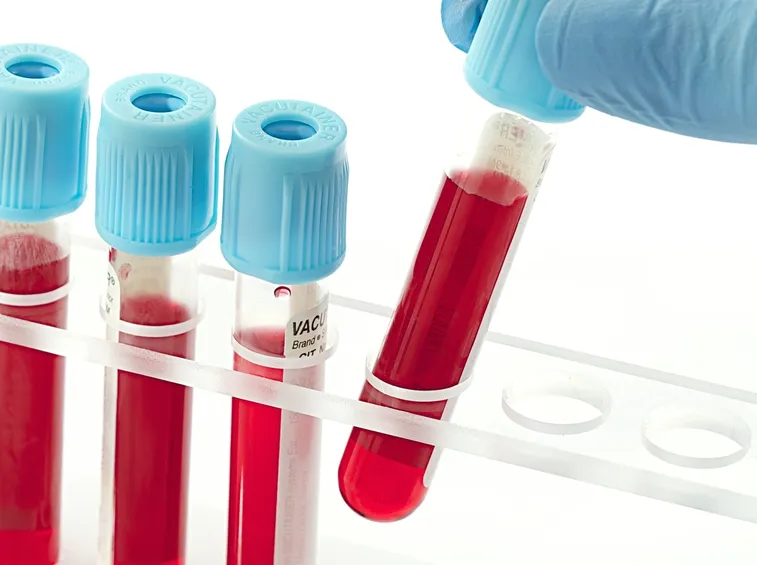 Campioni di sangue da sottoporre ad azotemia