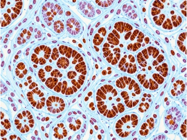 Fosfatasi acida prostatica al microscopio