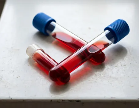 Esami del sangue
