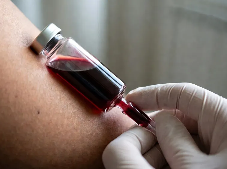 Prelievo sangue