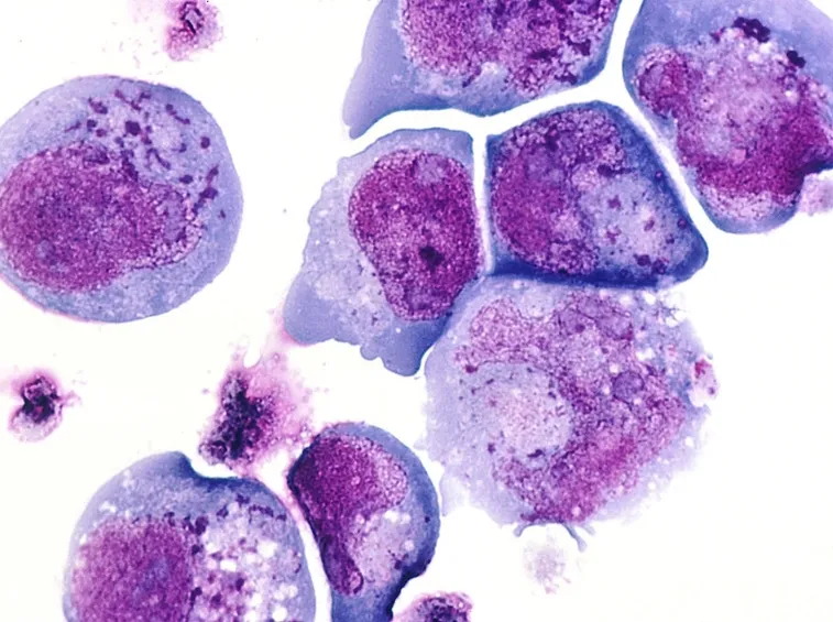 Cellule infettate dall'Herpes