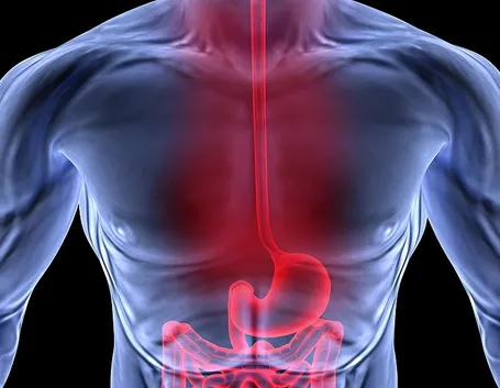 Localizzazione reflusso gastroesofageo