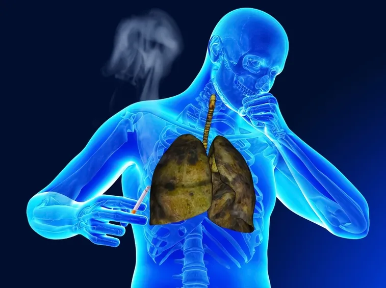 Fumo che ostruisce le vie respiratorie