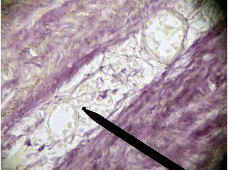 Scapola operazione