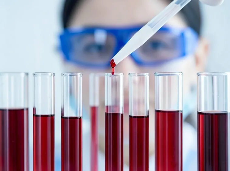 Analisi del sangue per mononucleosi
