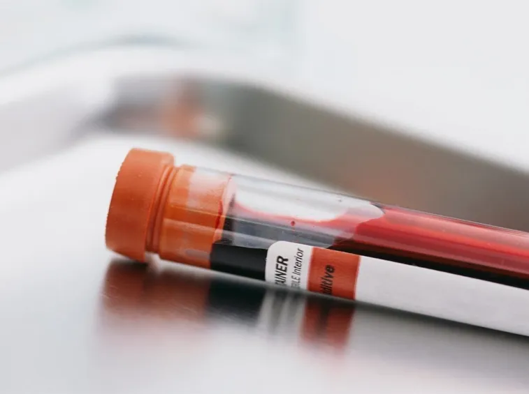 Campione di sangue per analisi