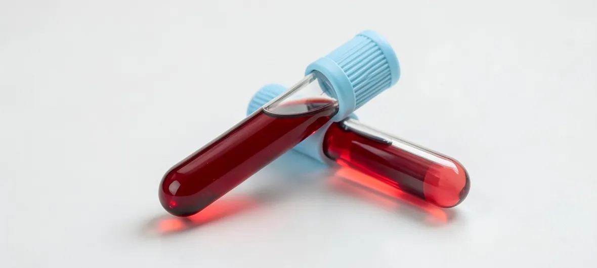 sangue per esami