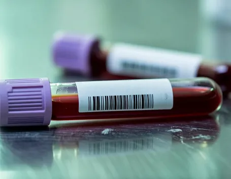 esami del sangue