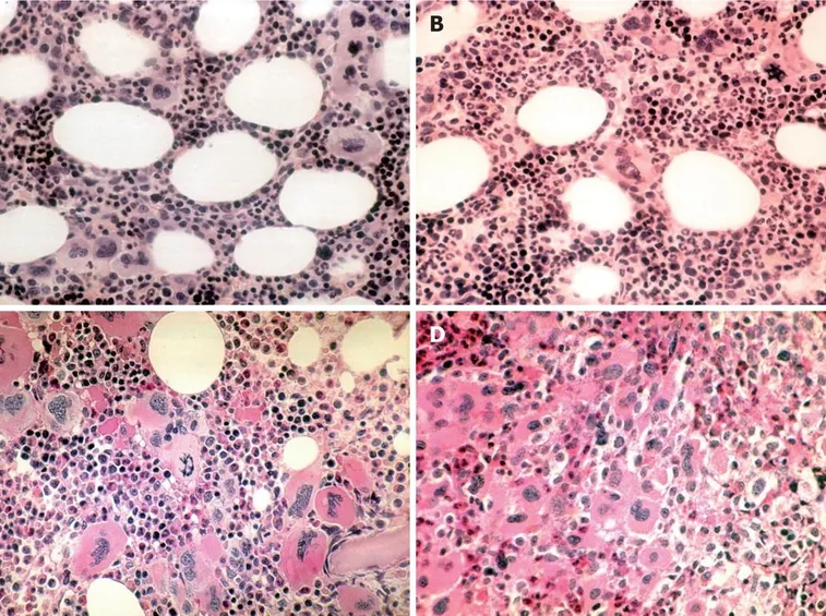 I globuli rossi al microscopio