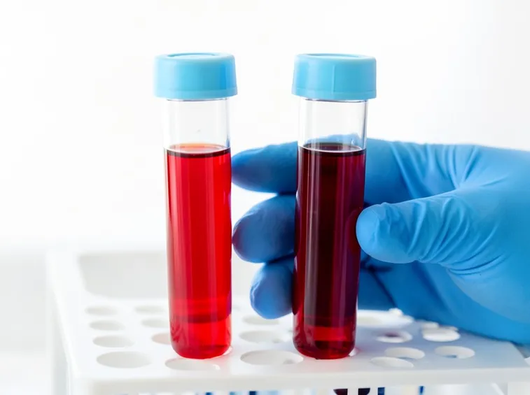 Provette analisi del sangue