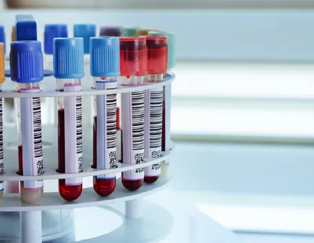 esami del sangue per mioglobina