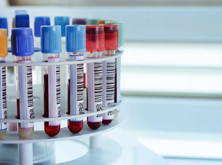 esami del sangue per mioglobina