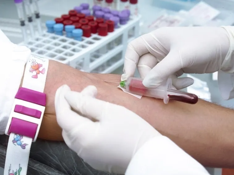 Prelievo del sangue