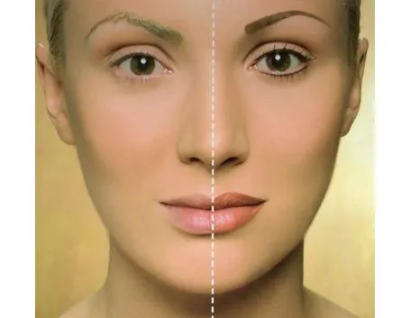 prima e dopo 