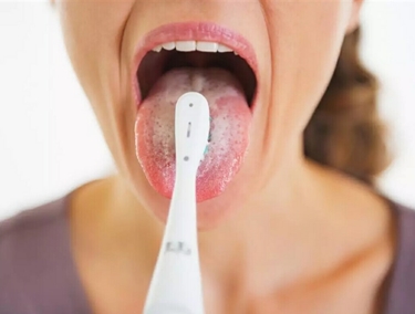 Rimuovere patina bianca dalla lingua