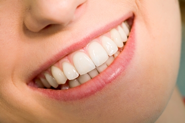 denti bianchi