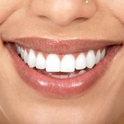 bellezza dei denti