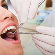 Curare placca dentale