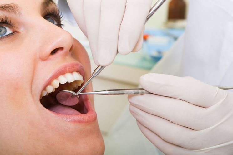 Curare placca dentale