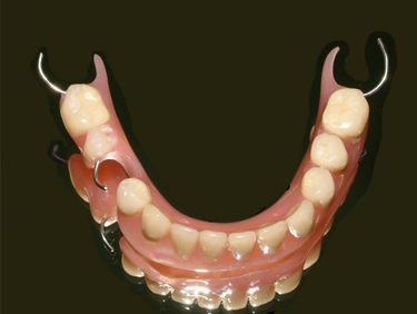 Protesi dentale combinata
