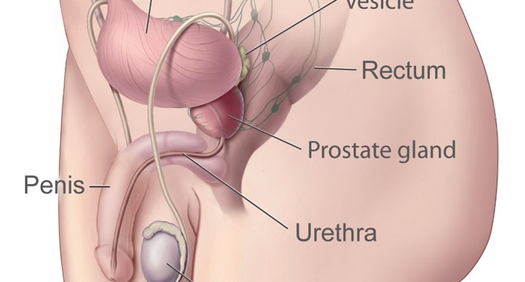 prostatite acuta sintomi efectul prostatitei asupra rectului