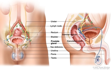 Tumore della prostata<p />