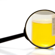 esame urine per ematuria