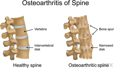 colonna vertebrale