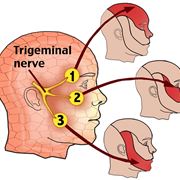 Anatomia del nervo trigemino