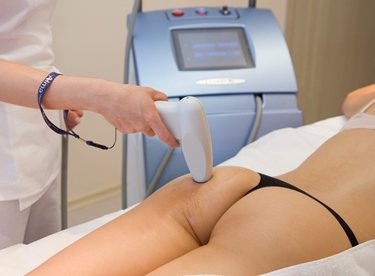 trattamenti per la cellulite