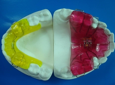 ortodonzia fissa 