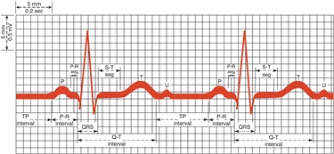 ECG normale su carta millimetrata