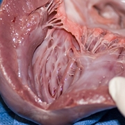 Anatomia del cuore umano