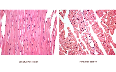 Cellule muscolari del miocardio