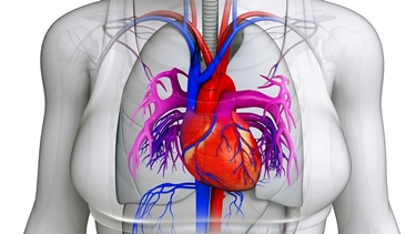 Cuore affetto da prolasso mitralico