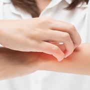 Eczema atopico in et adulta