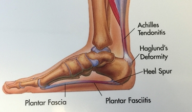 Ossa e fascia plantare