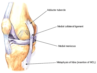 Legamento e menisco del ginocchio
