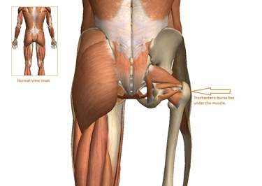 Posizione della borsa trocanterica