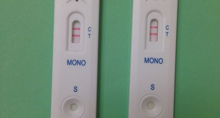 Il test rapido della mononucleosi