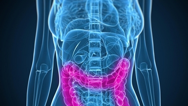 idrocolon terapia