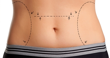 liposcultura addominale