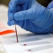 Esami del sangue in vitro