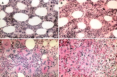 I globuli rossi al microscopio